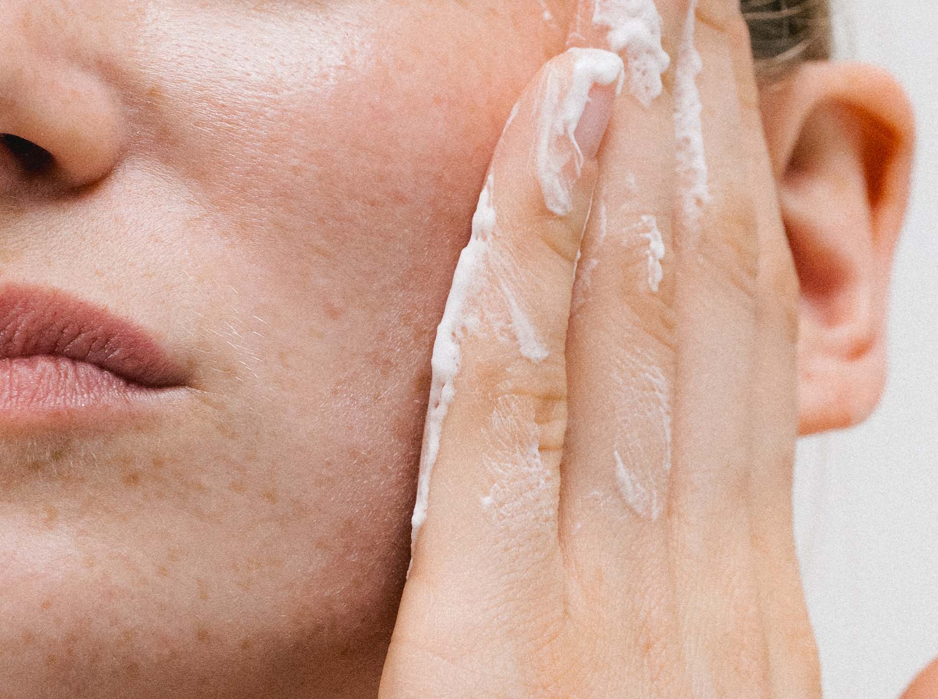 Kožná bariéra – prečo sa vaša pleť niekedy správa zvláštne